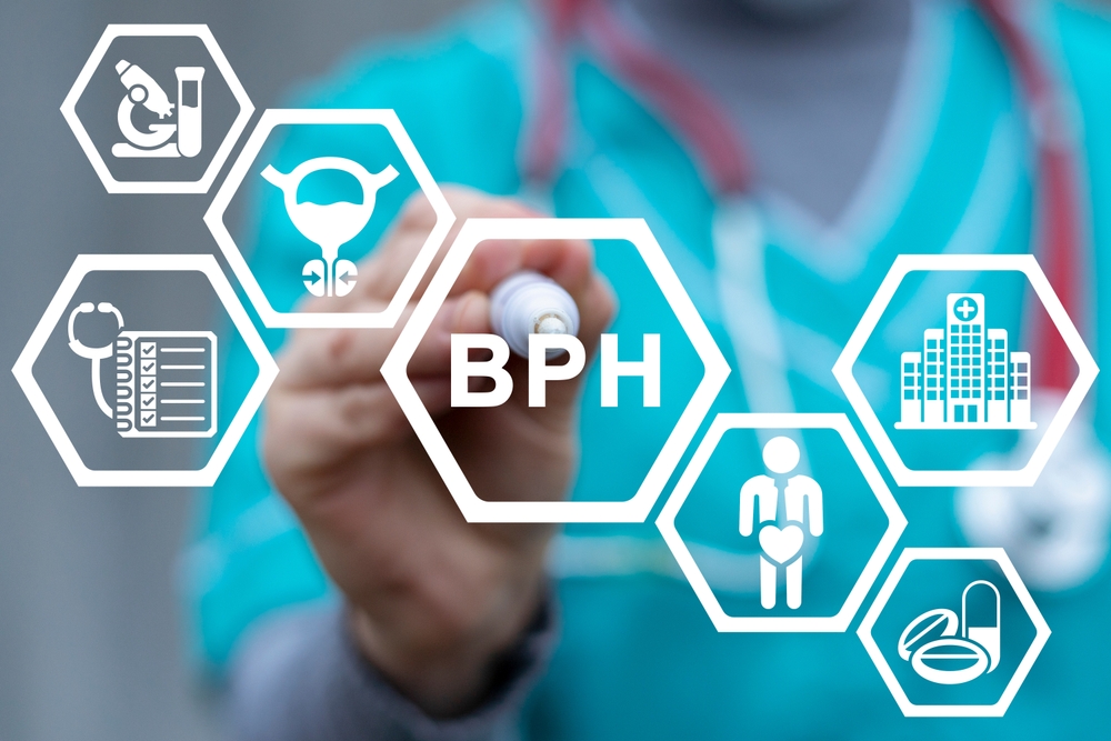 Medical concept of BPH Benign Prostatic Hyperplasia. Enlargement of prostate gland.