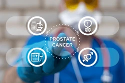 Prostate Cancer Screening