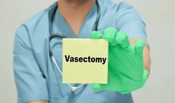 Vasectomy